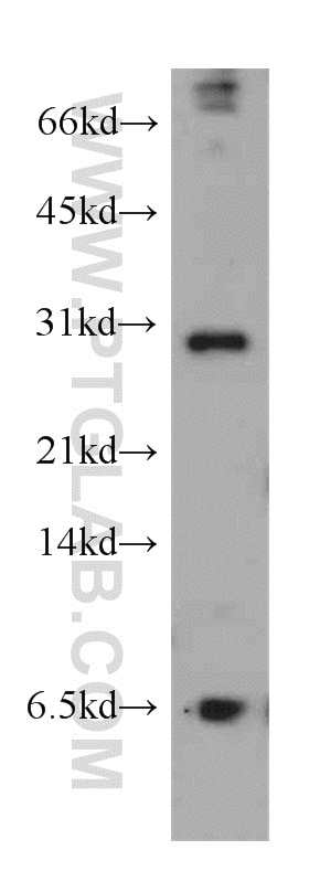 Western Blot (WB) analysis of mouse heart tissue using THAP1 Polyclonal antibody (12584-1-AP)