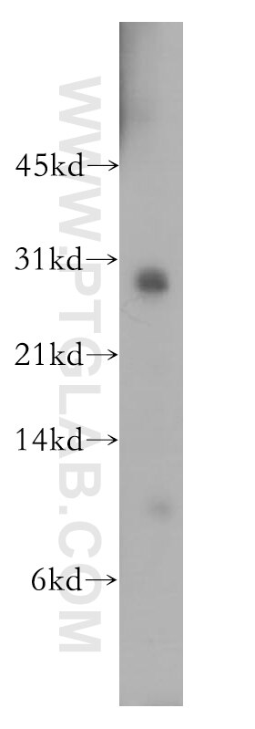 Western Blot (WB) analysis of human brain tissue using THAP1 Polyclonal antibody (12584-1-AP)