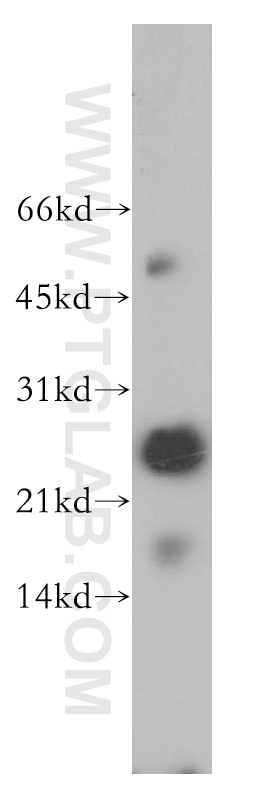 Western Blot (WB) analysis of A375 cells using THAP1 Polyclonal antibody (12584-1-AP)