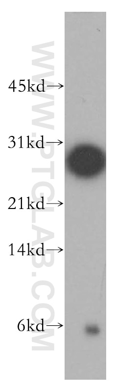 Western Blot (WB) analysis of SGC-7901 cells using THAP1 Polyclonal antibody (12584-1-AP)