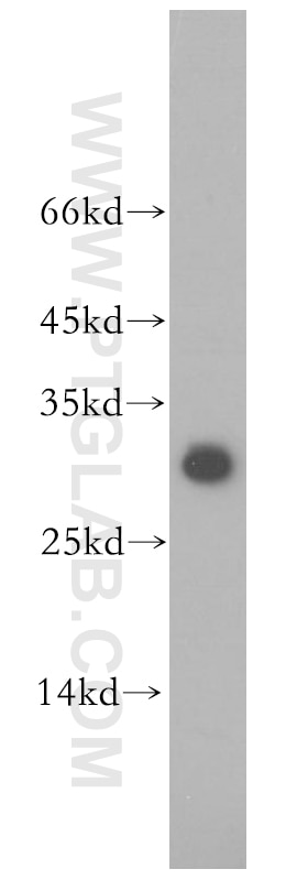 Western Blot (WB) analysis of HeLa cells using THAP1 Polyclonal antibody (12584-1-AP)