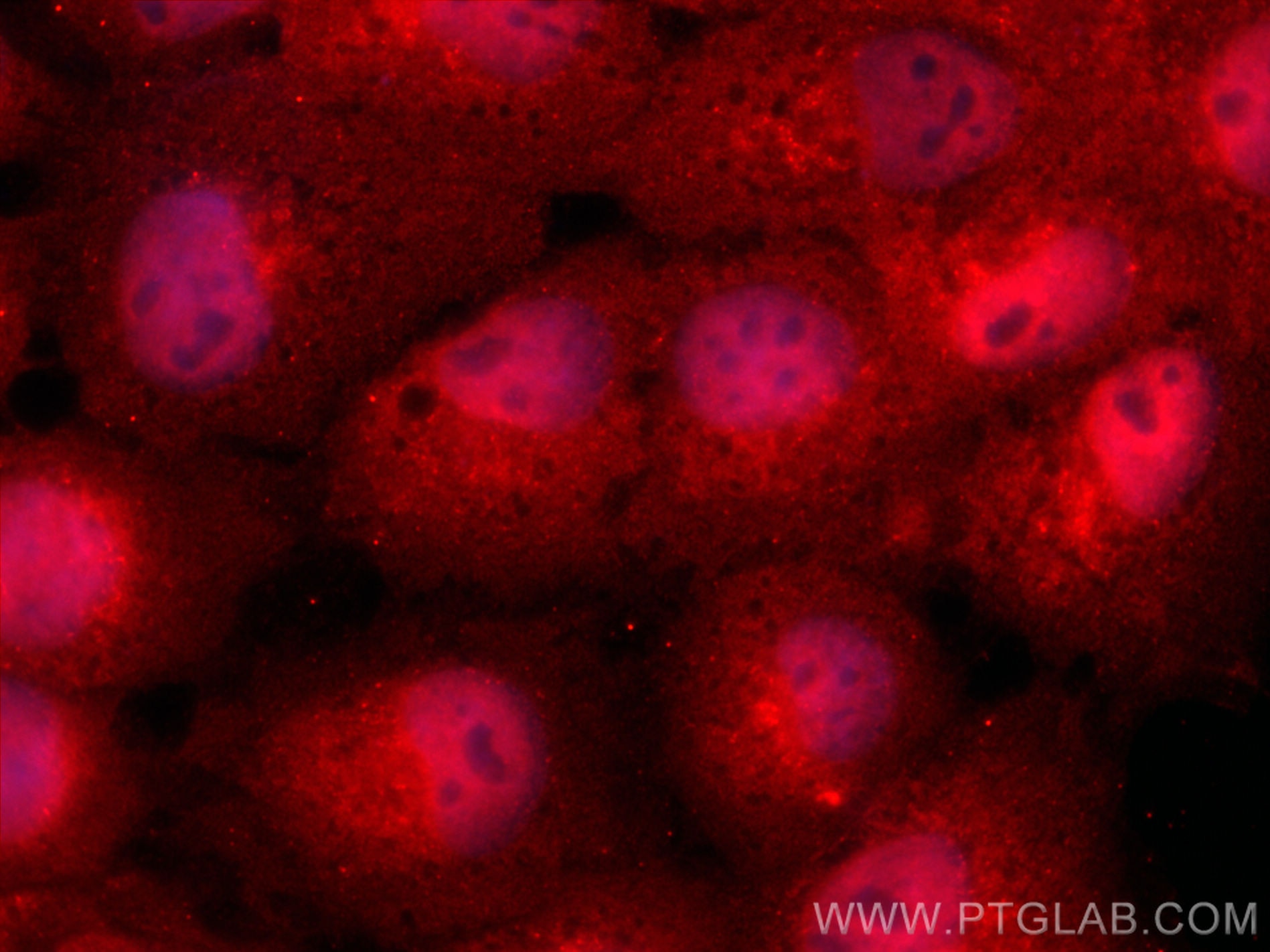 Immunofluorescence (IF) / fluorescent staining of A431 cells using THAP10 Polyclonal antibody (21897-1-AP)