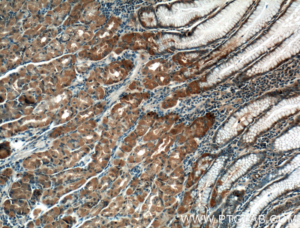 Immunohistochemistry (IHC) staining of human stomach tissue using THAP10 Polyclonal antibody (21897-1-AP)