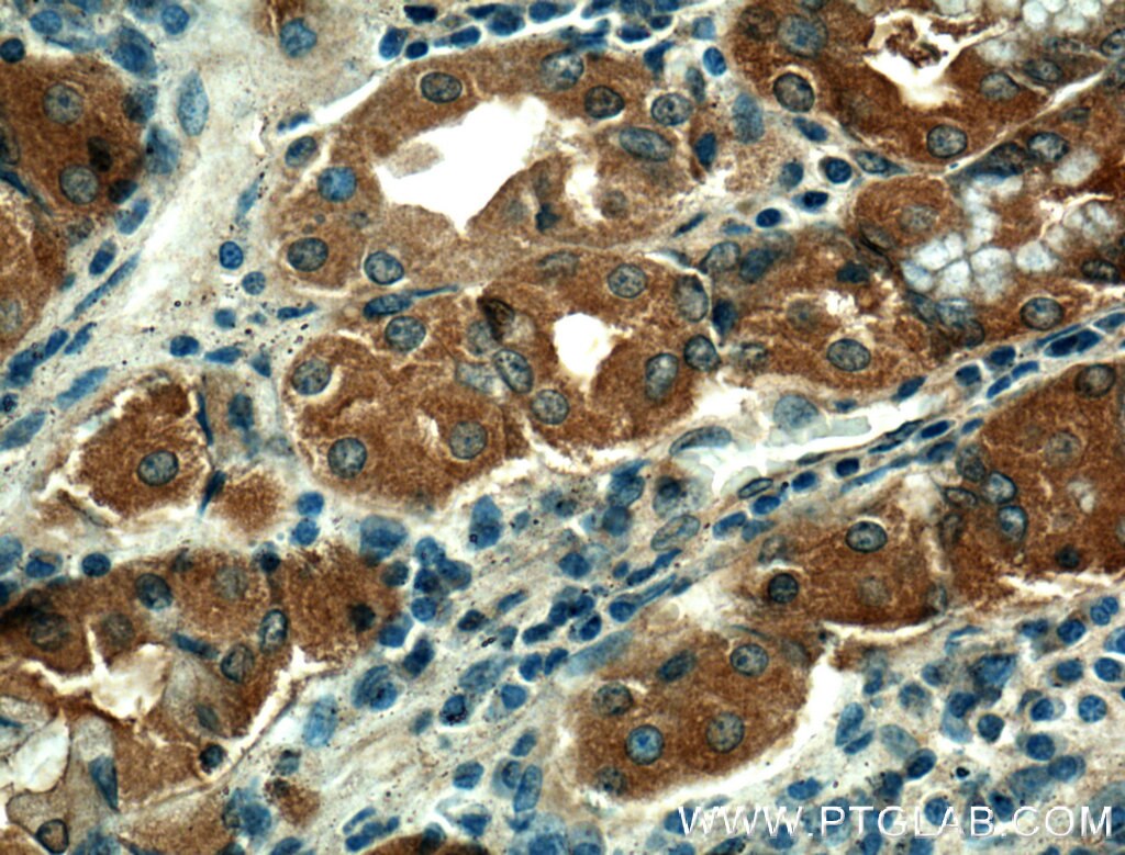 Immunohistochemistry (IHC) staining of human stomach tissue using THAP10 Polyclonal antibody (21897-1-AP)