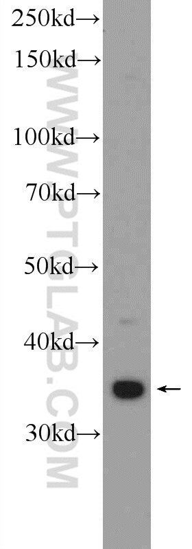 Western Blot (WB) analysis of HeLa cells using THAP10 Polyclonal antibody (21897-1-AP)