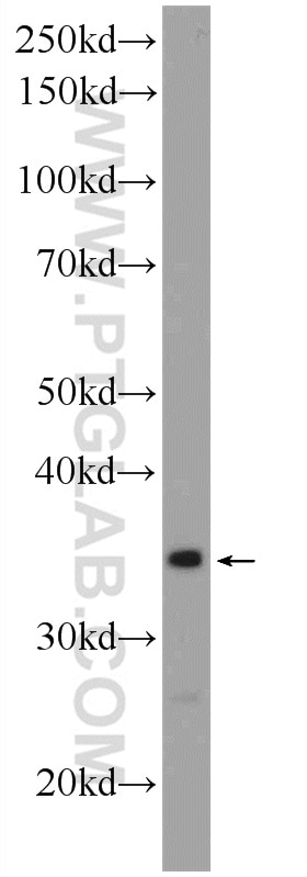 Western Blot (WB) analysis of SMMC-7721 cells using THAP10 Polyclonal antibody (21897-1-AP)