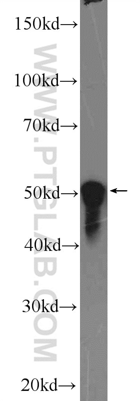 Western Blot (WB) analysis of Jurkat cells using THAP11 Polyclonal antibody (23030-1-AP)