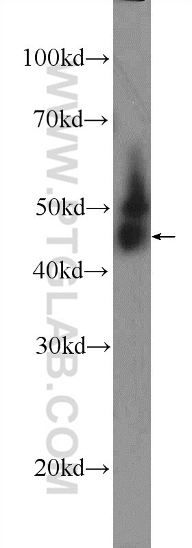 Western Blot (WB) analysis of HeLa cells using THAP11 Polyclonal antibody (23030-1-AP)