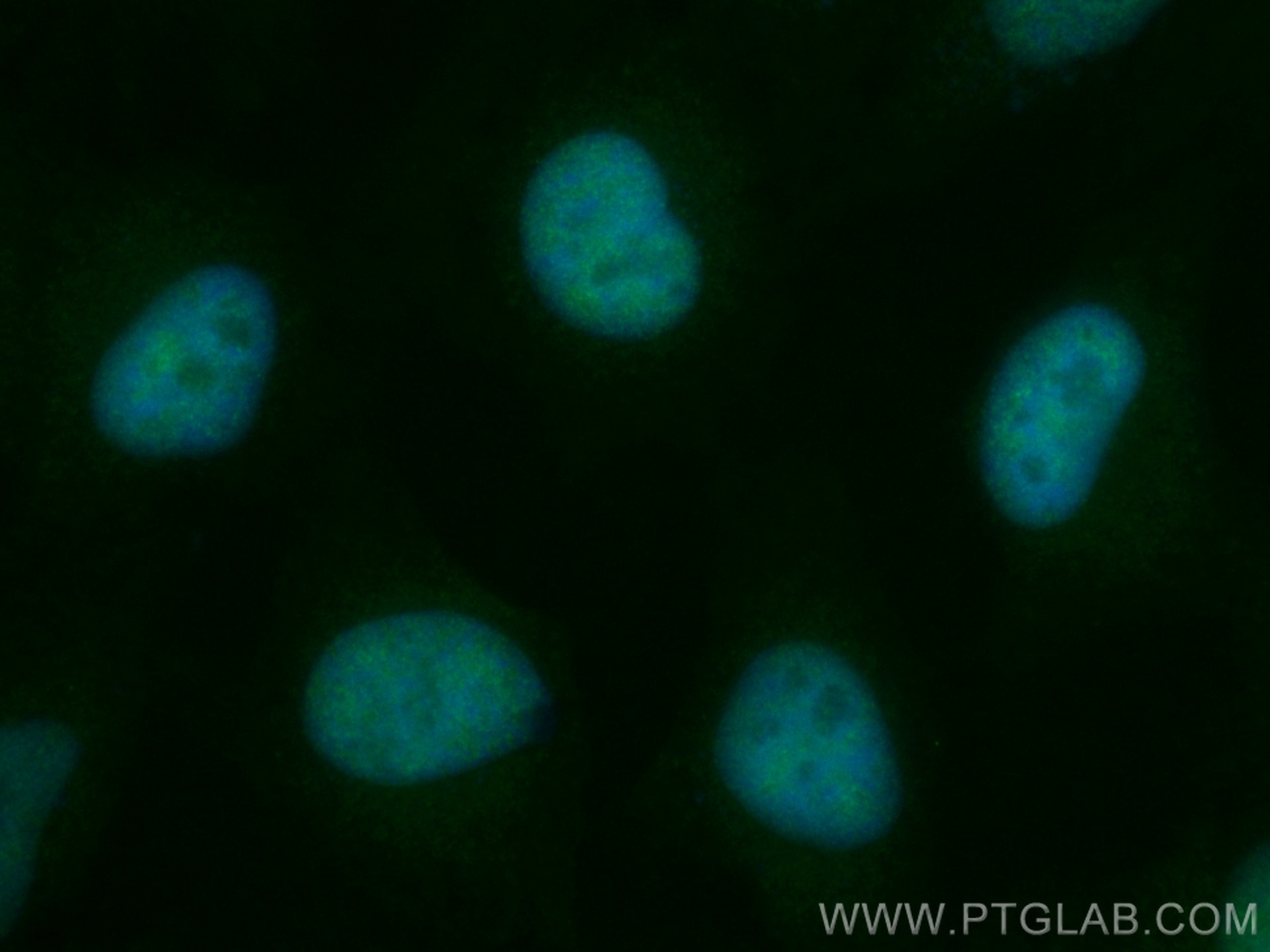 Immunofluorescence (IF) / fluorescent staining of HeLa cells using CoraLite® Plus 488-conjugated THAP11 Recombinant a (CL488-84373-6)