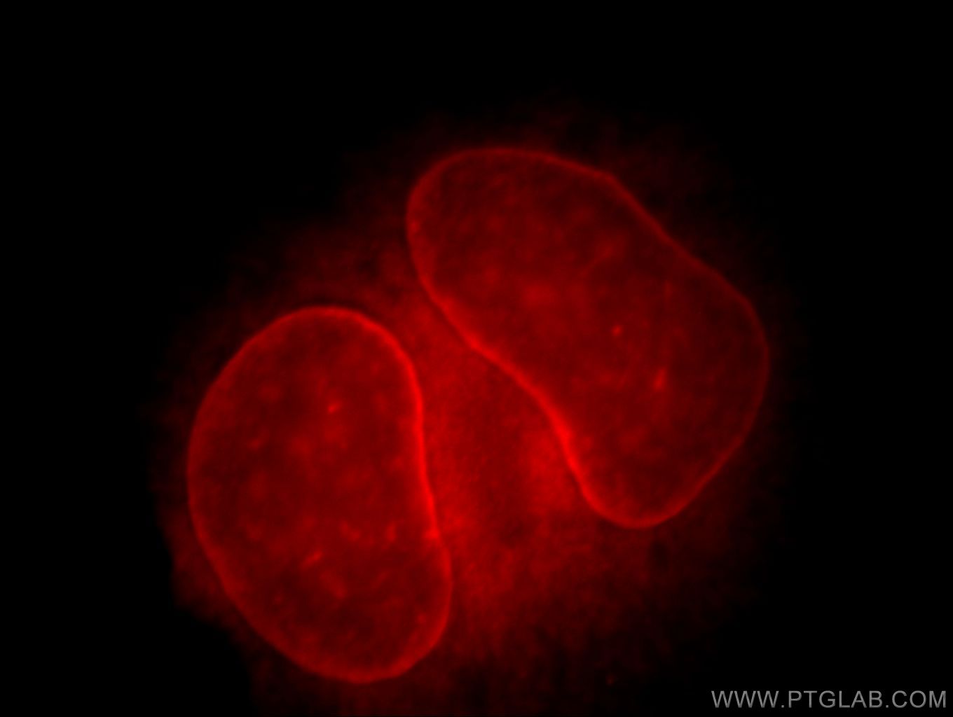 Immunofluorescence (IF) / fluorescent staining of HeLa cells using THAP2 Polyclonal antibody (20853-1-AP)