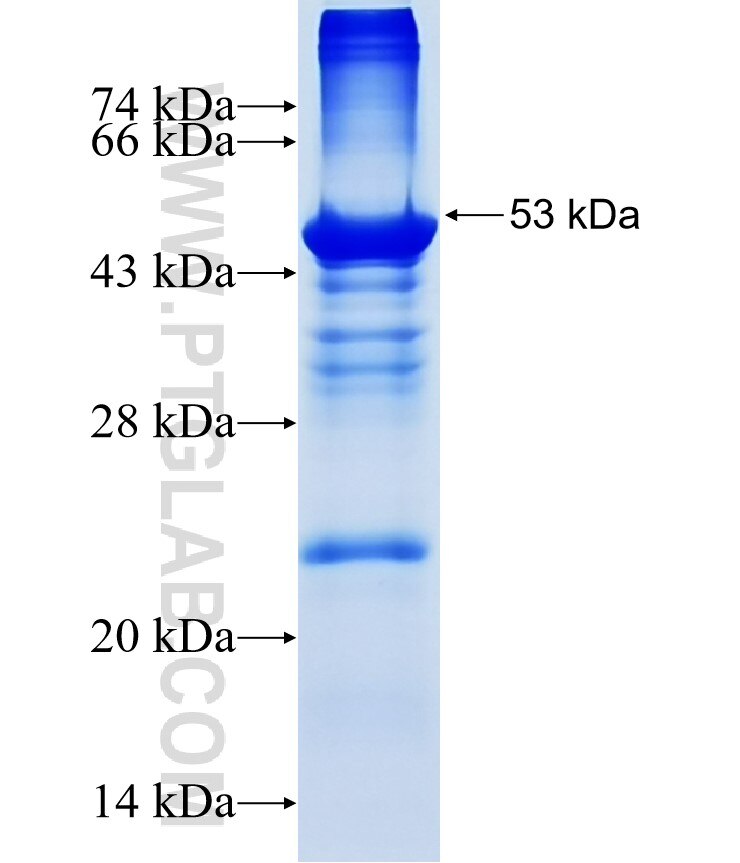THAP6 fusion protein Ag14934 SDS-PAGE