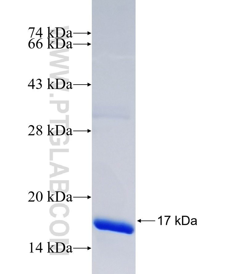 THAP9 fusion protein Ag37249 SDS-PAGE THAP9 fusion protein Ag37249 SDS-PAGE