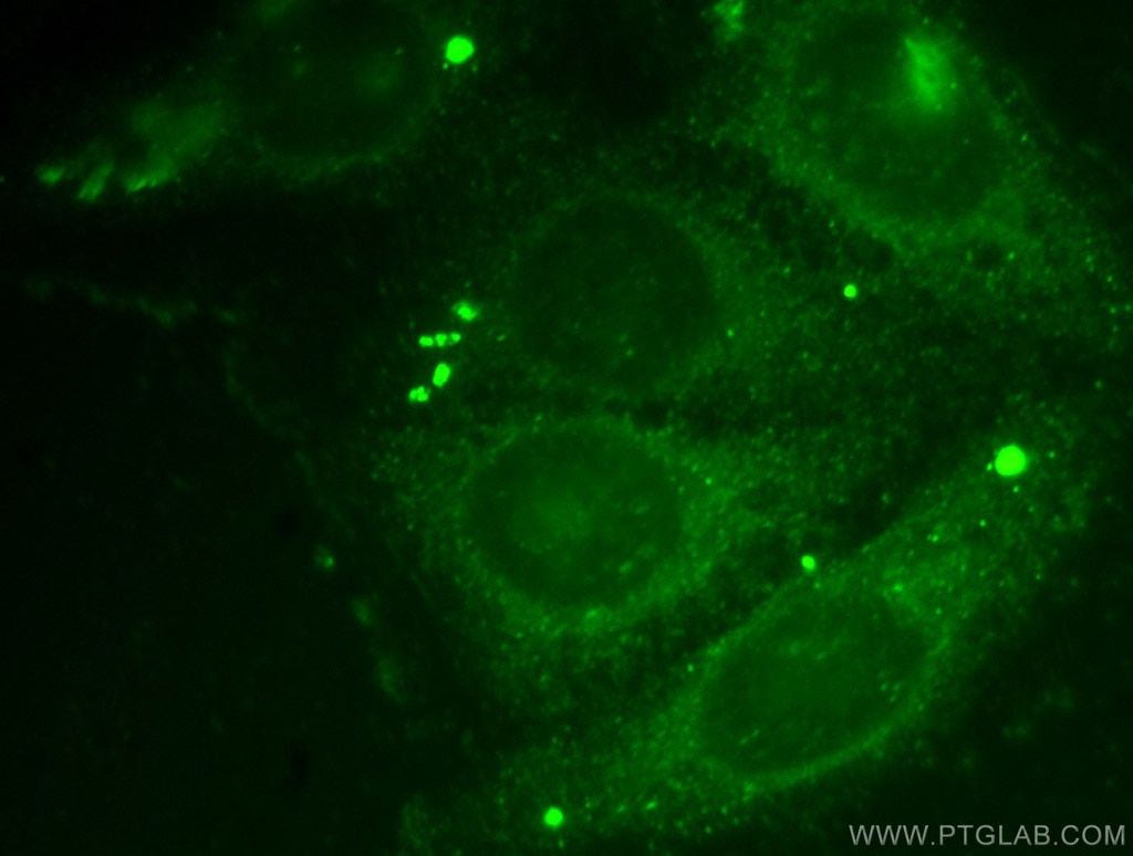 Thrombomodulin