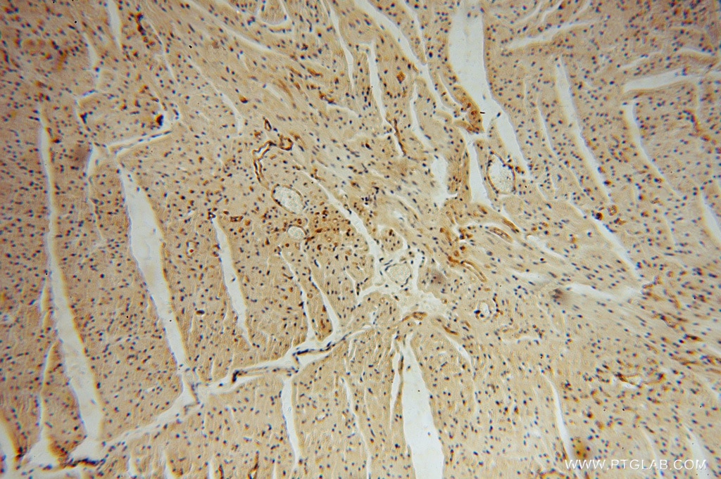 IHC staining of human heart using 14318-1-AP