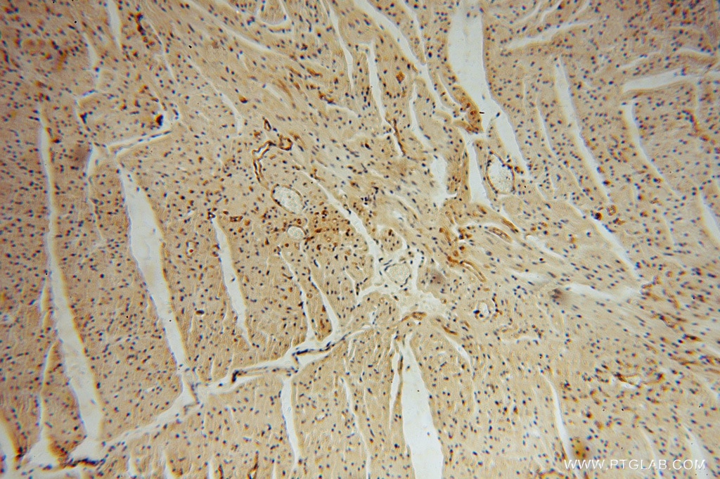 Immunohistochemistry (IHC) staining of human heart tissue using Thrombomodulin Polyclonal antibody (14318-1-AP)