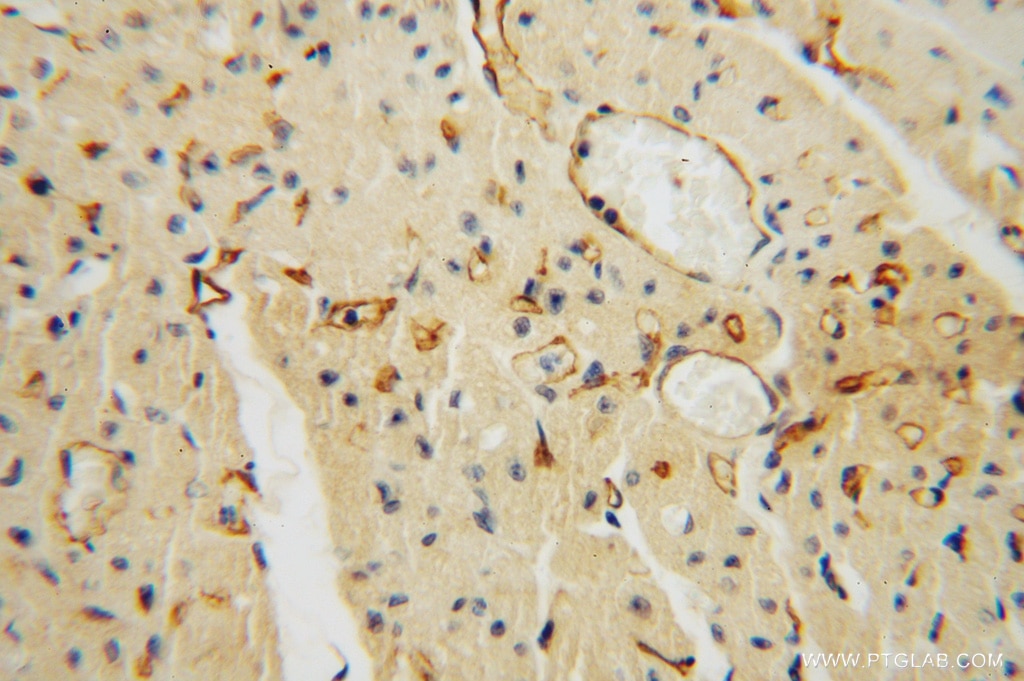 IHC staining of human heart using 14318-1-AP