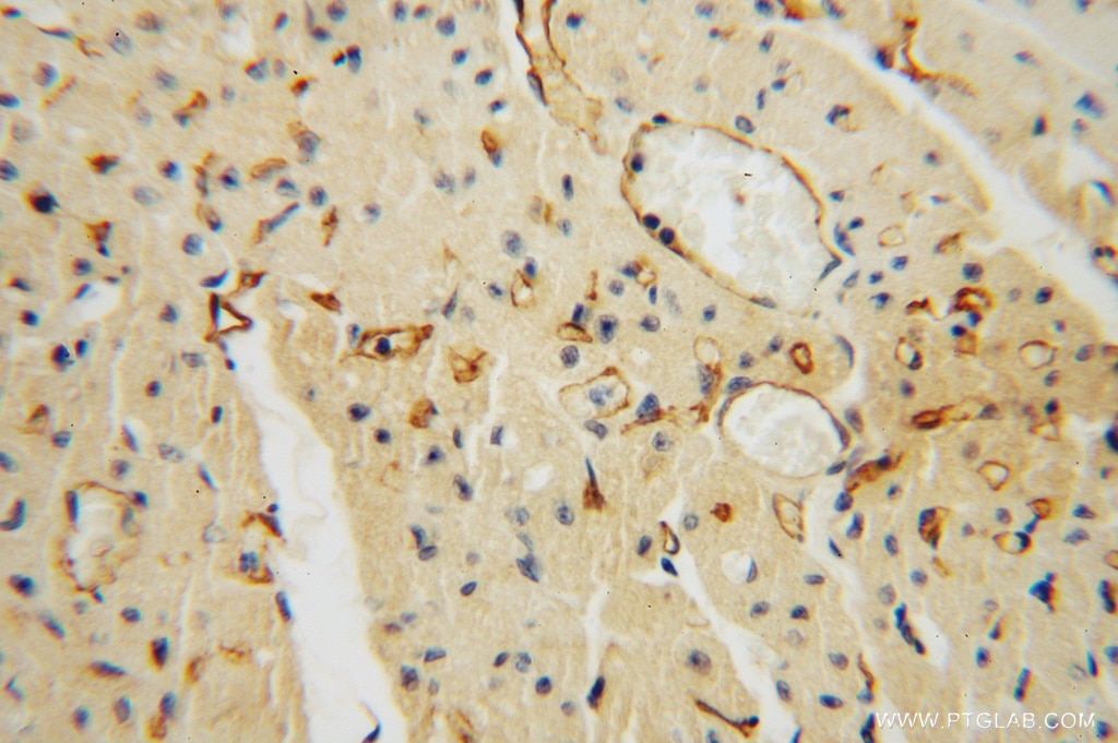 Immunohistochemistry (IHC) staining of human heart tissue using Thrombomodulin Polyclonal antibody (14318-1-AP)