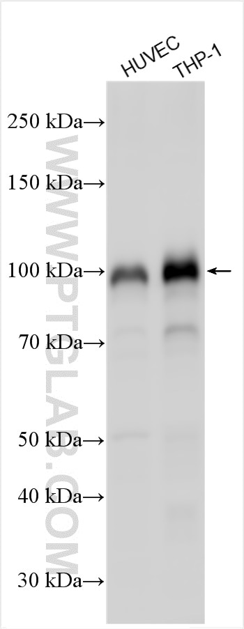 Western Blot (WB) analysis of various lysates using Thrombomodulin Polyclonal antibody (14318-1-AP)