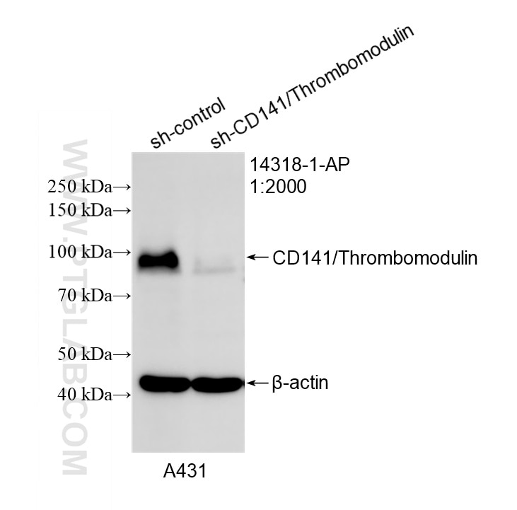 WB result of CD141/Thrombomodulin antibody (14318-1-AP; 1:2000; incubated at room temperature for 1.5 hours) with sh-Control and sh-CD141/Thrombomodulin transfected A431 cells. Western Blot (WB) analysis of A431 cells using CD141/Thrombomodulin Polyclonal antibody (14318-1-AP)