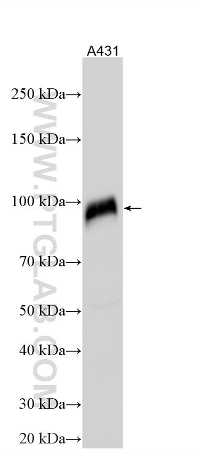 A431 cells lysates were subjected to SDS PAGE followed by western blot with 14318-1-AP (CD141/Thrombomodulin antibody) at dilution of 1:4000 incubated at room temperature for 1.5 hours. Western Blot (WB) analysis of various lysates using CD141/Thrombomodulin Polyclonal antibody (14318-1-AP)