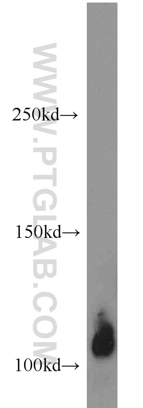 Western Blot (WB) analysis of human heart tissue using Thrombomodulin Polyclonal antibody (14318-1-AP)