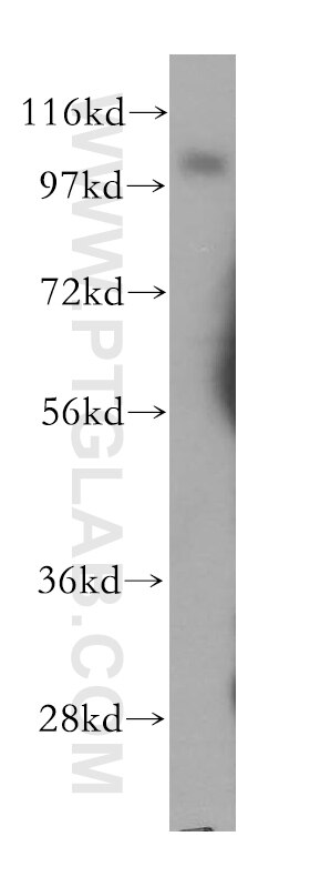 Western Blot (WB) analysis of human heart tissue using Thrombomodulin Polyclonal antibody (14318-1-AP)