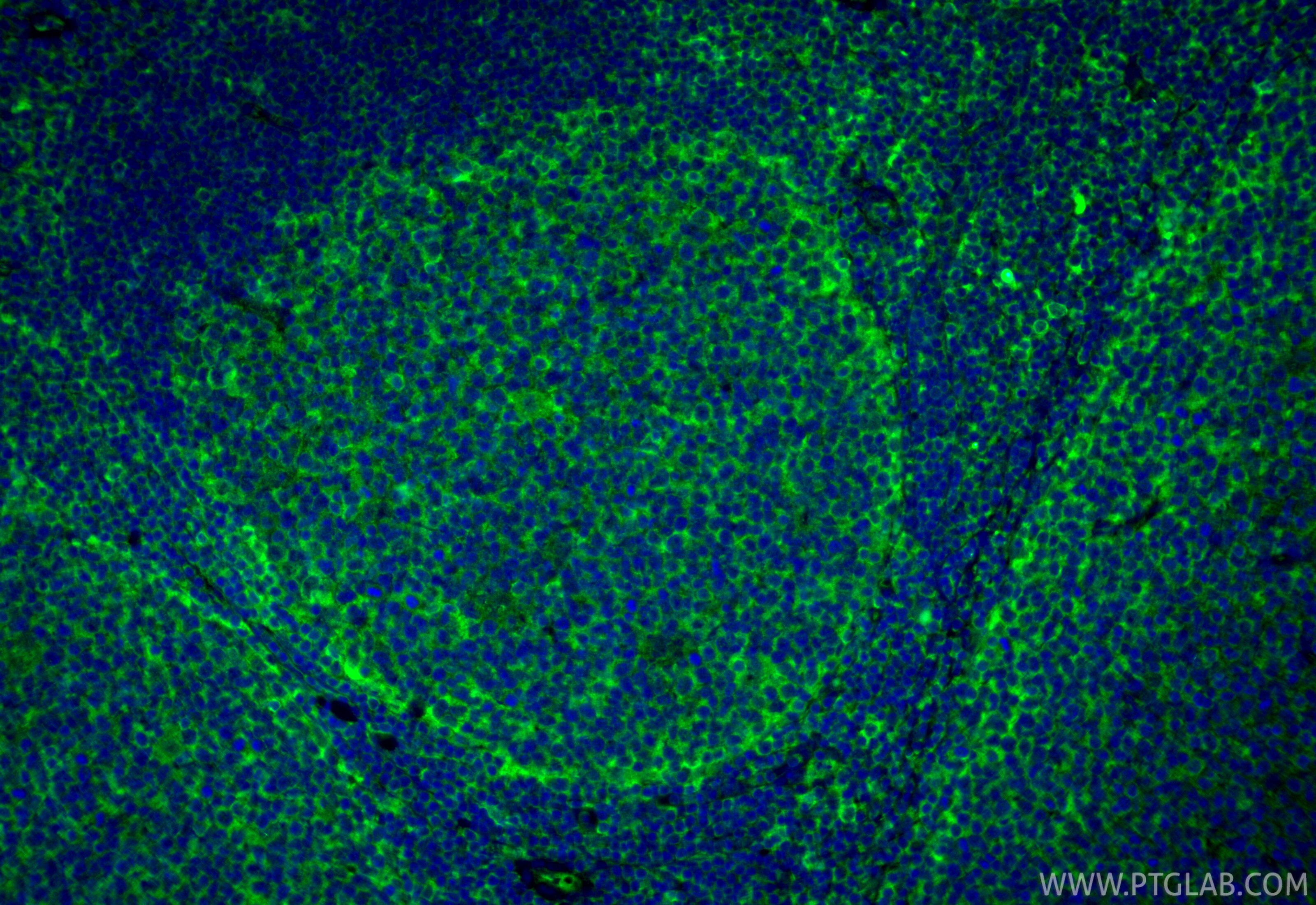 IF Staining of human tonsillitis using 67831-1-Ig Immunofluorescence (IF) / fluorescent staining of human tonsillitis tissue using CD141/Thrombomodulin Monoclonal antibody (67831-1-Ig)