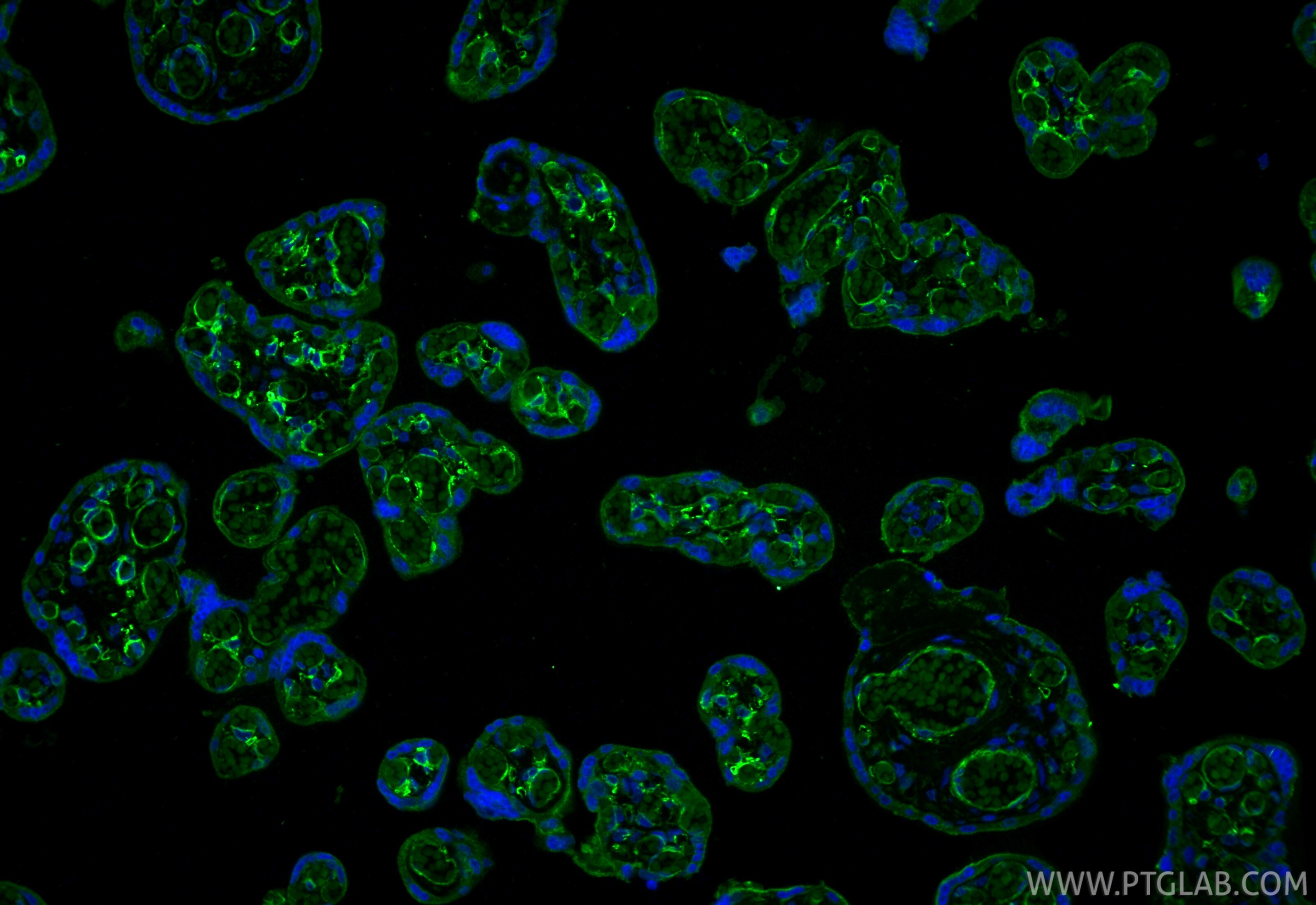 IF Staining of human placenta using 67831-1-Ig Immunofluorescence (IF) / fluorescent staining of human placenta tissue using CD141/Thrombomodulin Monoclonal antibody (67831-1-Ig)