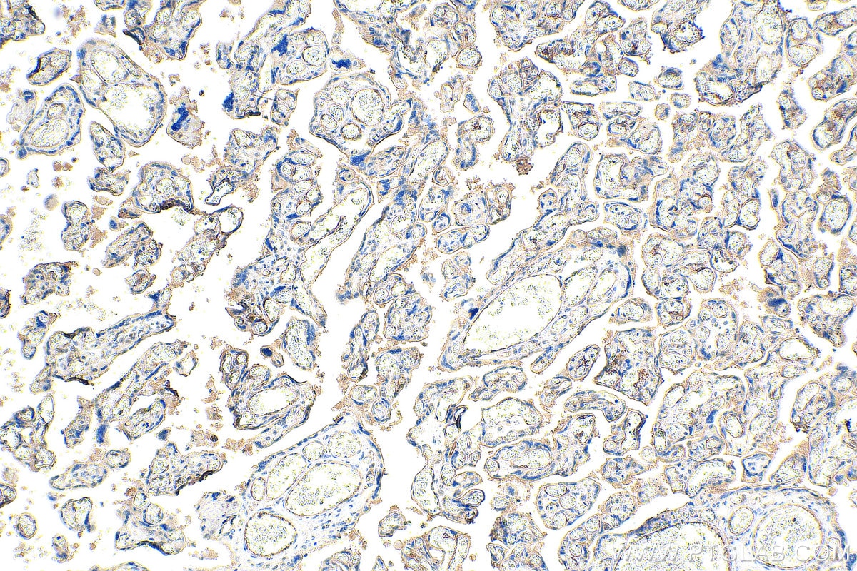 Immunohistochemistry (IHC) staining of human placenta tissue using THBD Monoclonal antibody (67831-1-Ig)