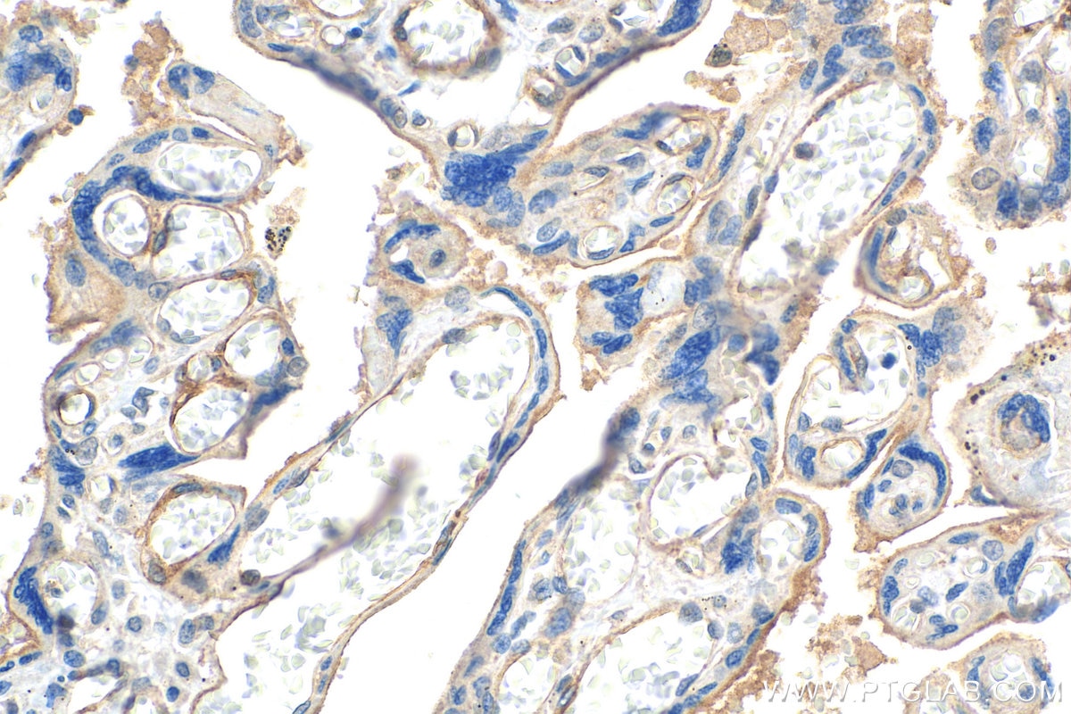 CD141/Thrombomodulin
