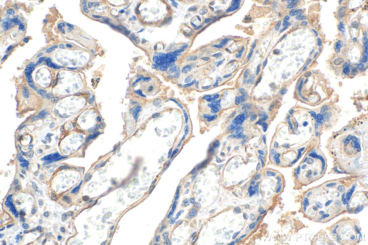 IHC staining of human placenta using 67831-1-Ig