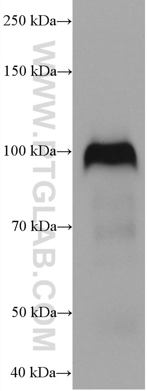Western Blot (WB) analysis of human placenta tissue using CD141/Thrombomodulin Monoclonal antibody (67831-1-Ig)