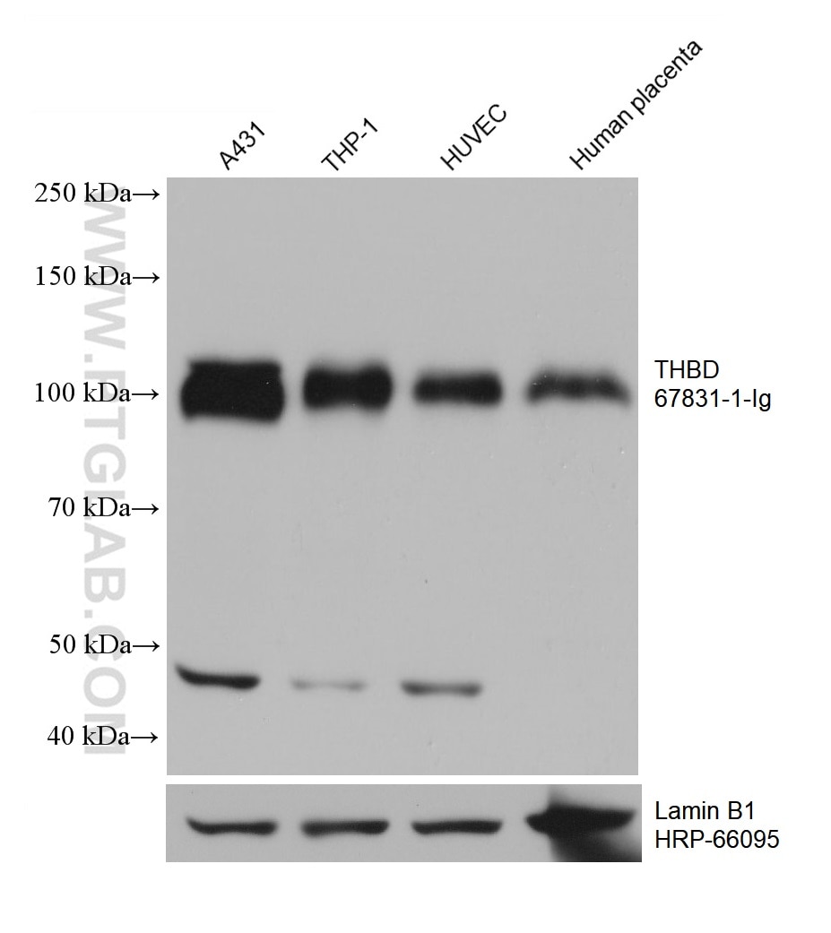 Western Blot (WB) analysis of various lysates using THBD Monoclonal antibody (67831-1-Ig)