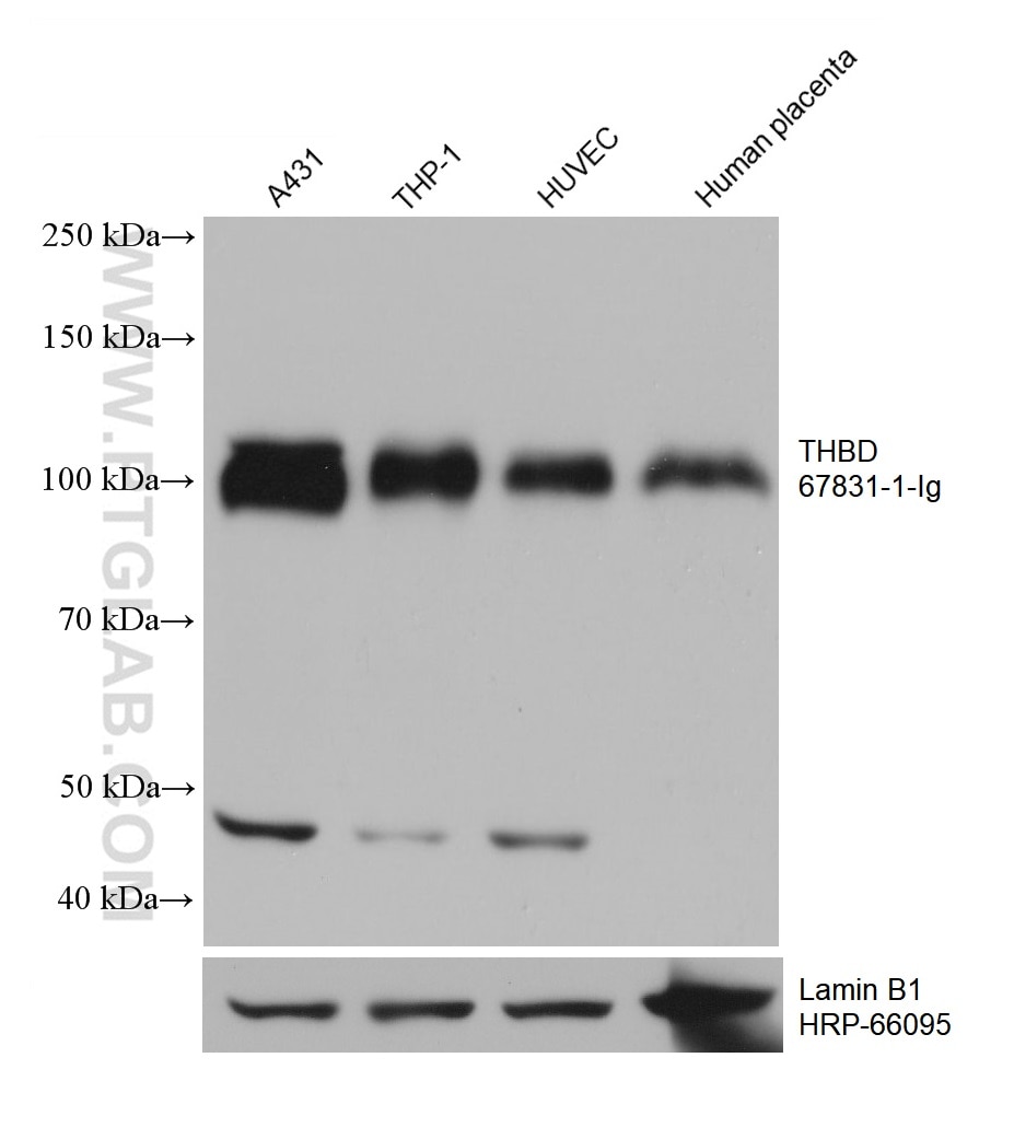 Western Blot (WB) analysis of various lysates using CD141/Thrombomodulin Monoclonal antibody (67831-1-Ig)