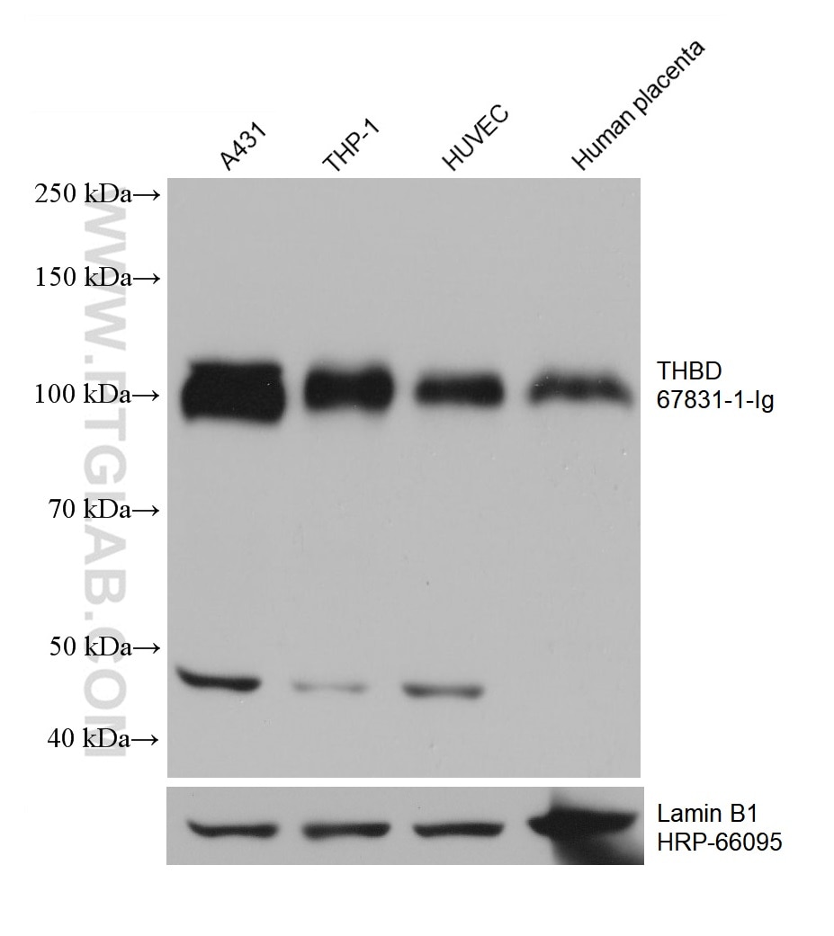 WB analysis using 67831-1-Ig