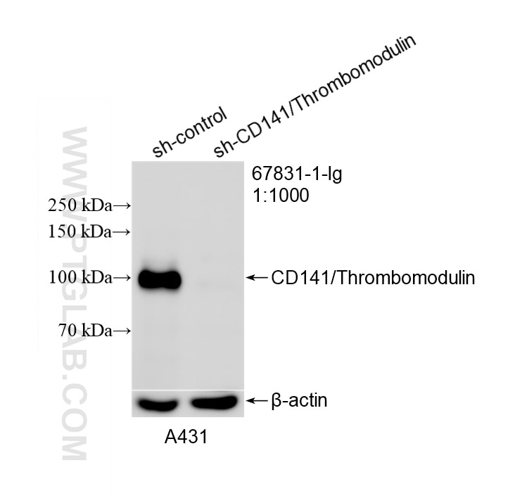 Western Blot (WB) analysis of A431 cells using CD141/Thrombomodulin Monoclonal antibody (67831-1-Ig)