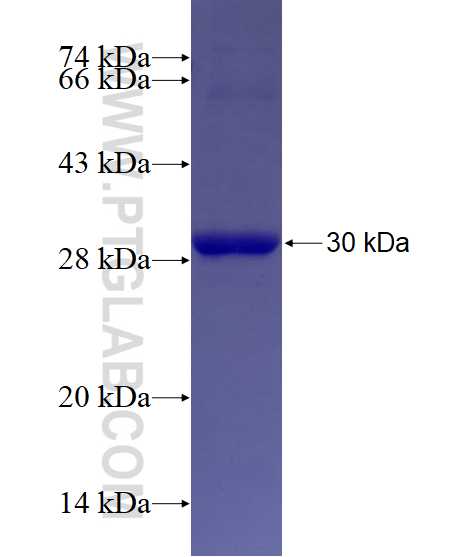 THBS1 fusion protein Ag29129 SDS-PAGE