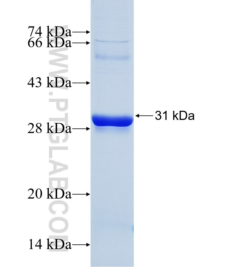 THBS1 fusion protein Ag29129 SDS-PAGE