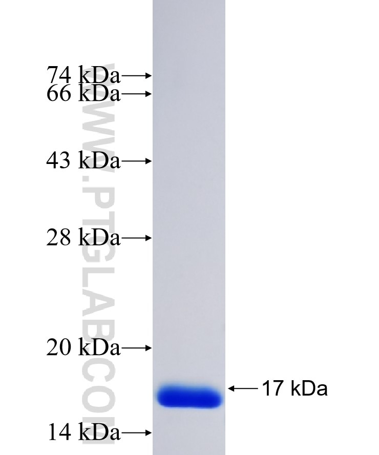 THBS2 fusion protein Ag25750 SDS-PAGE
