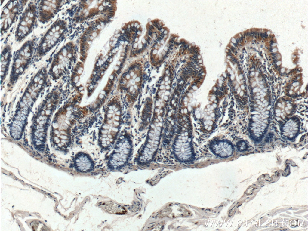 Immunohistochemistry (IHC) staining of human colon tissue using Thrombospondin 3-Specific Polyclonal antibody (19727-1-AP)