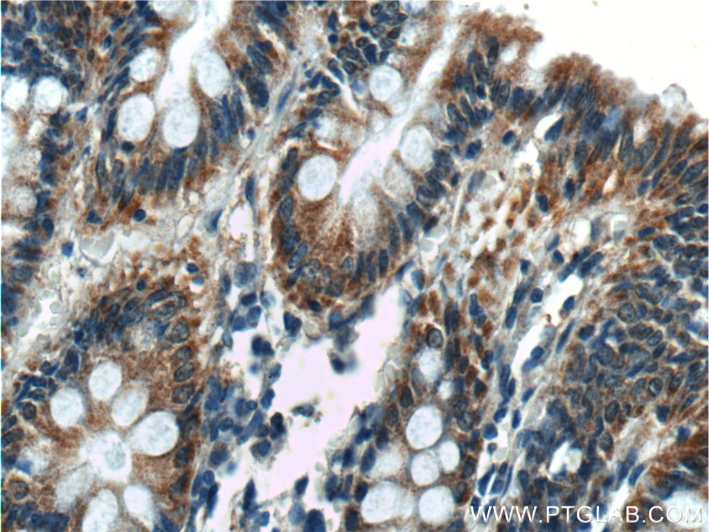 Immunohistochemistry (IHC) staining of human colon tissue using Thrombospondin 3-Specific Polyclonal antibody (19727-1-AP)