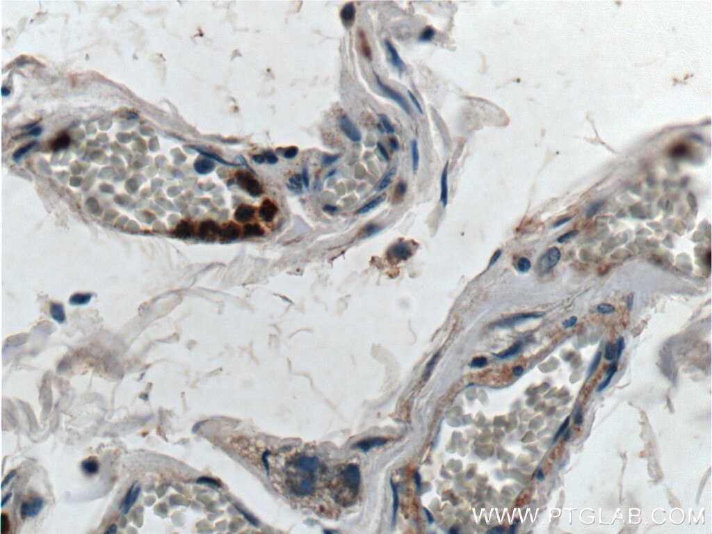 Immunohistochemistry (IHC) staining of human colon tissue using Thrombospondin 3-Specific Polyclonal antibody (19727-1-AP)