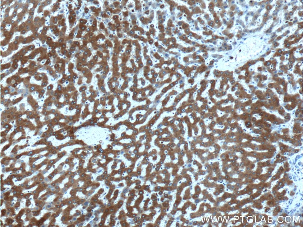 Immunohistochemistry (IHC) staining of human liver tissue using Thrombospondin 3-Specific Polyclonal antibody (19727-1-AP)