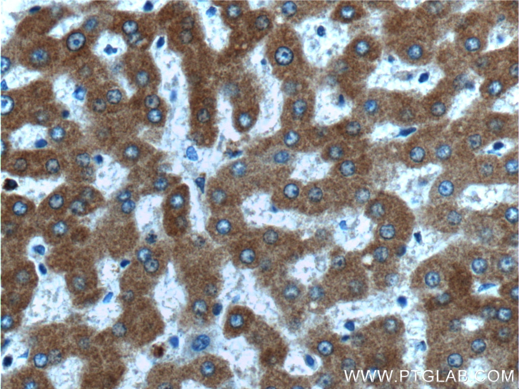 Immunohistochemistry (IHC) staining of human liver tissue using Thrombospondin 3-Specific Polyclonal antibody (19727-1-AP)