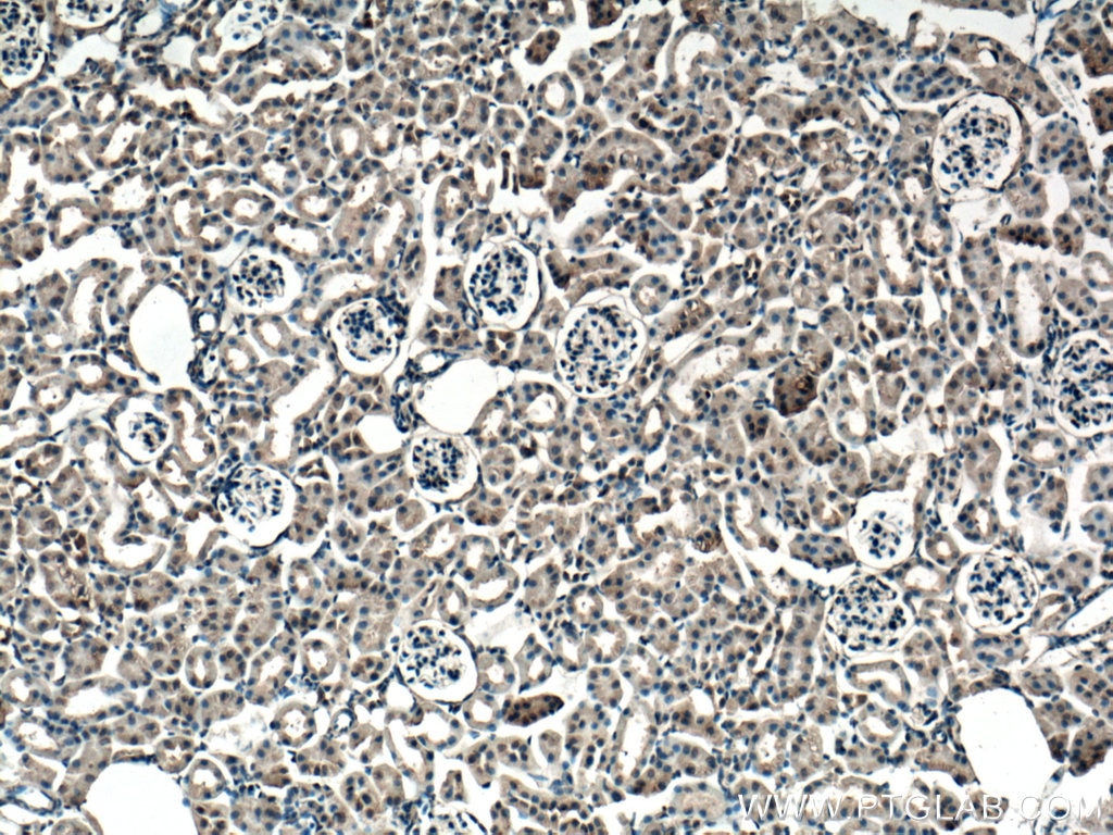 Immunohistochemistry (IHC) staining of mouse kidney tissue using Thrombospondin 3-Specific Polyclonal antibody (19727-1-AP)