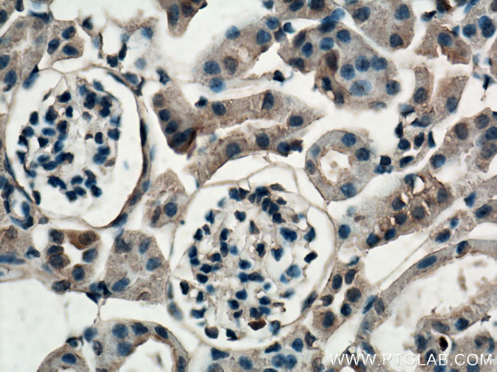 IHC staining of mouse kidney using 19727-1-AP