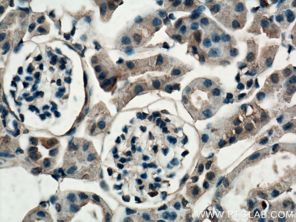 Immunohistochemistry (IHC) staining of mouse kidney tissue using Thrombospondin 3-Specific Polyclonal antibody (19727-1-AP)