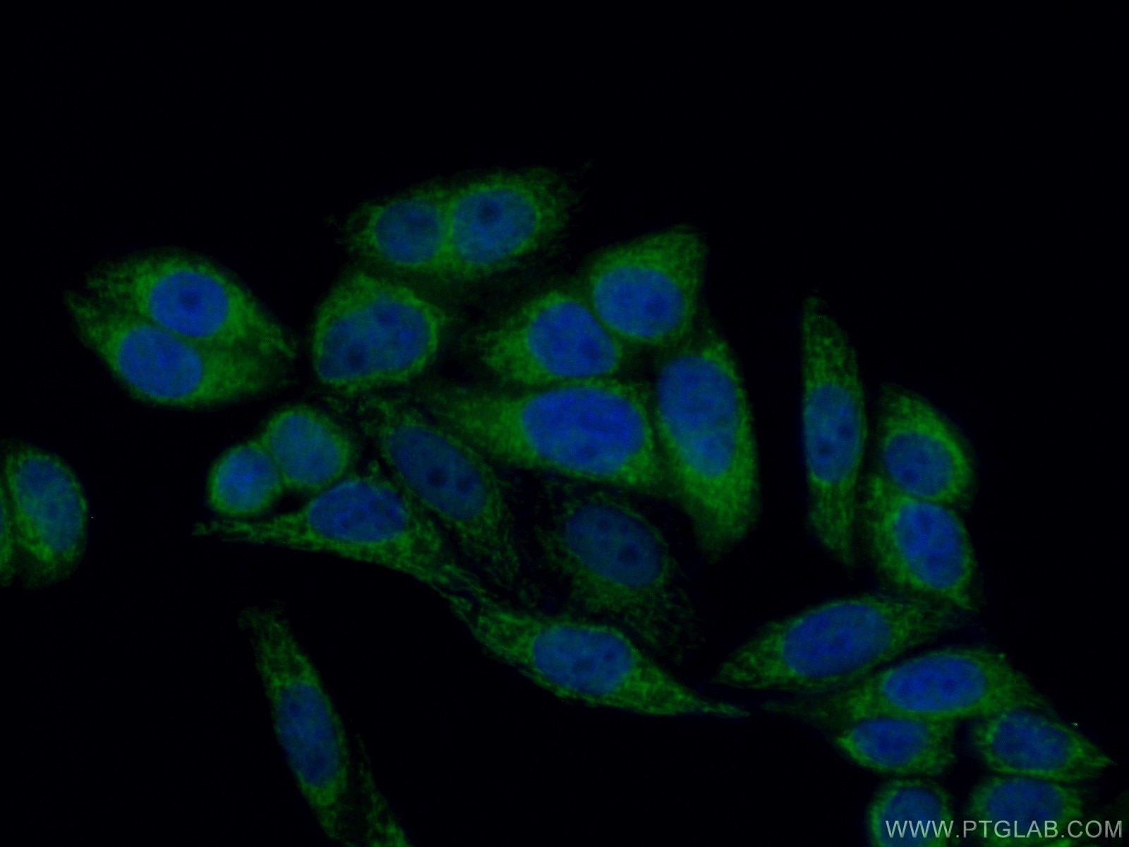 Immunofluorescence (IF) / fluorescent staining of HepG2 cells using THEM2 Polyclonal antibody (16782-1-AP)