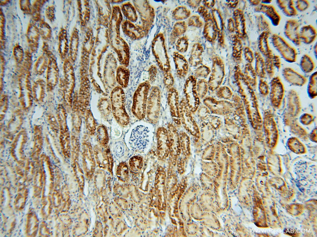 Immunohistochemistry (IHC) staining of human kidney tissue using THEM2 Polyclonal antibody (16782-1-AP)