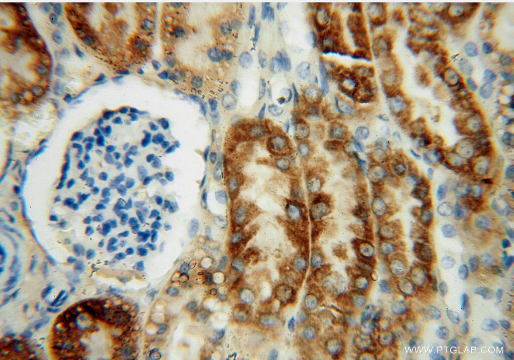 Immunohistochemistry (IHC) staining of human kidney tissue using THEM2 Polyclonal antibody (16782-1-AP)